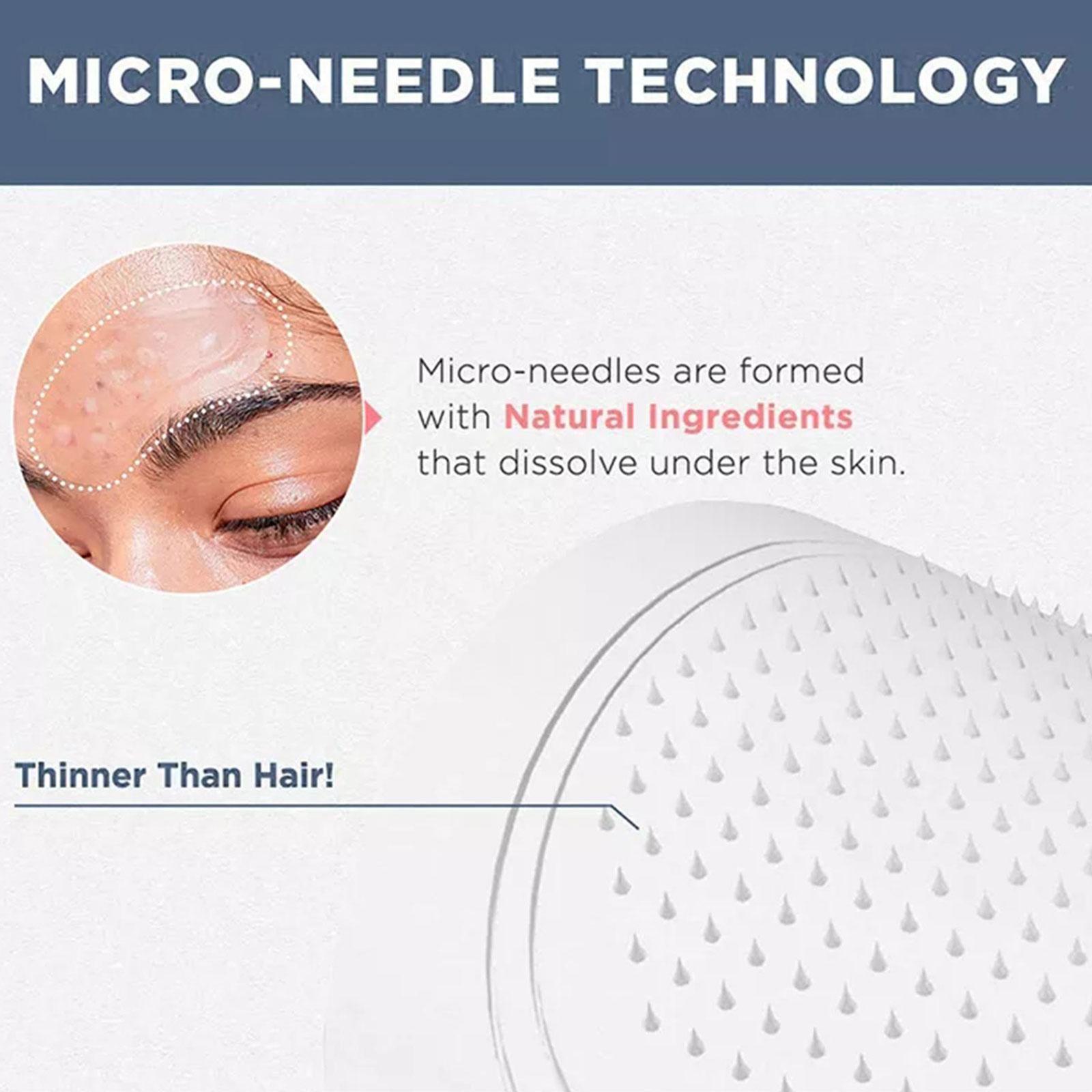 0.2mm Micro-needle Eye Patch M - đánh giá và giá Microneedle Patch Eye